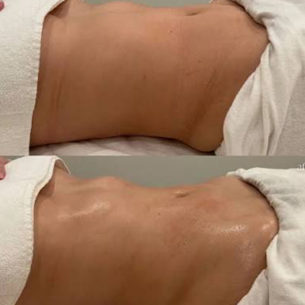 Lymphatic Drainage at Vault Luxe Artistry Co. in Burlington, NC