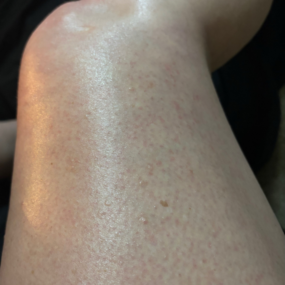 Full Leg Wax at Elegance Beauty Spa in Anderson, IN