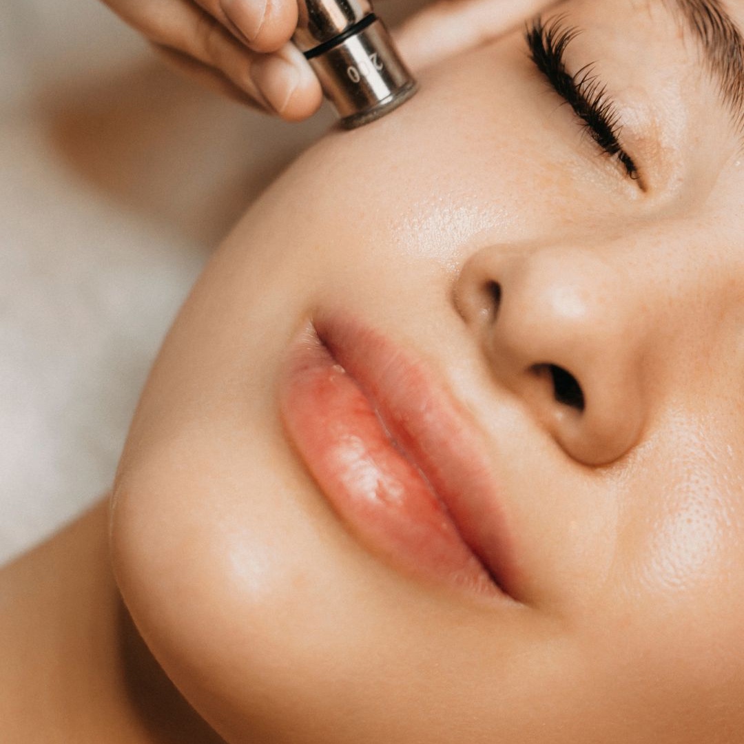 Neck & Chest Microdermabrasion