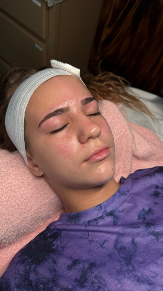 Teen Facial