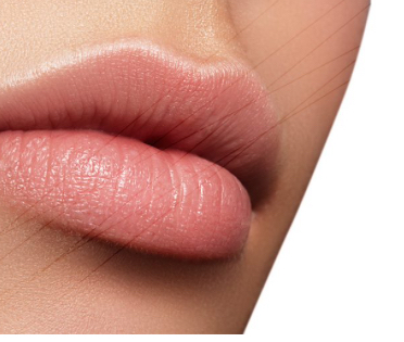 Love Your Lips! (Lip Mesotherapie)