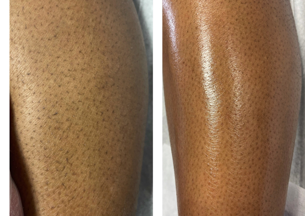 Half Leg Wax