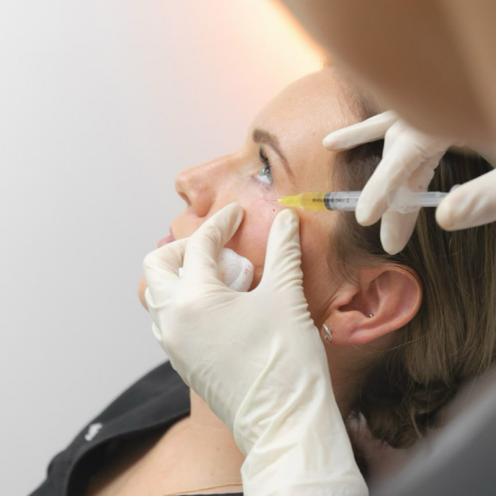 PRP Under Eye Injections at Sharon Nicole Aesthetics in Patchogue, NY