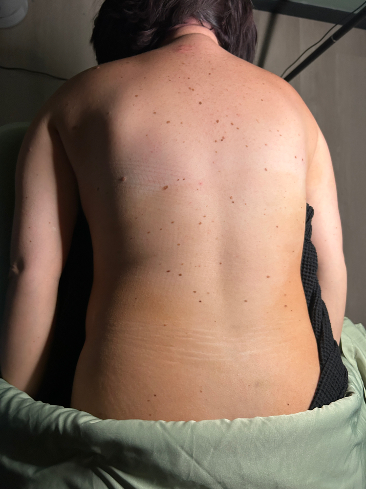 Back Facial & Facial