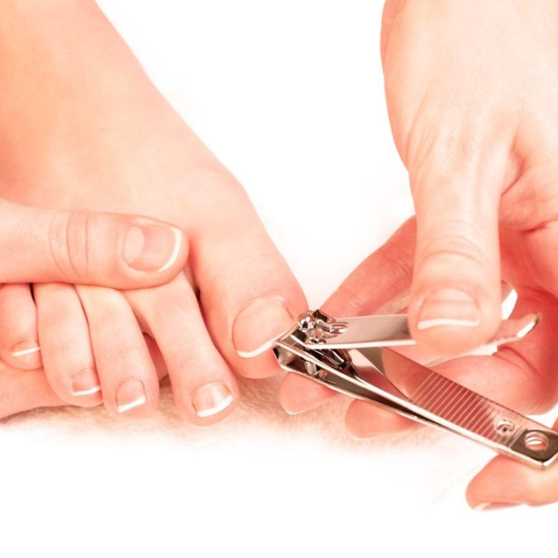 Toe Nail Trim