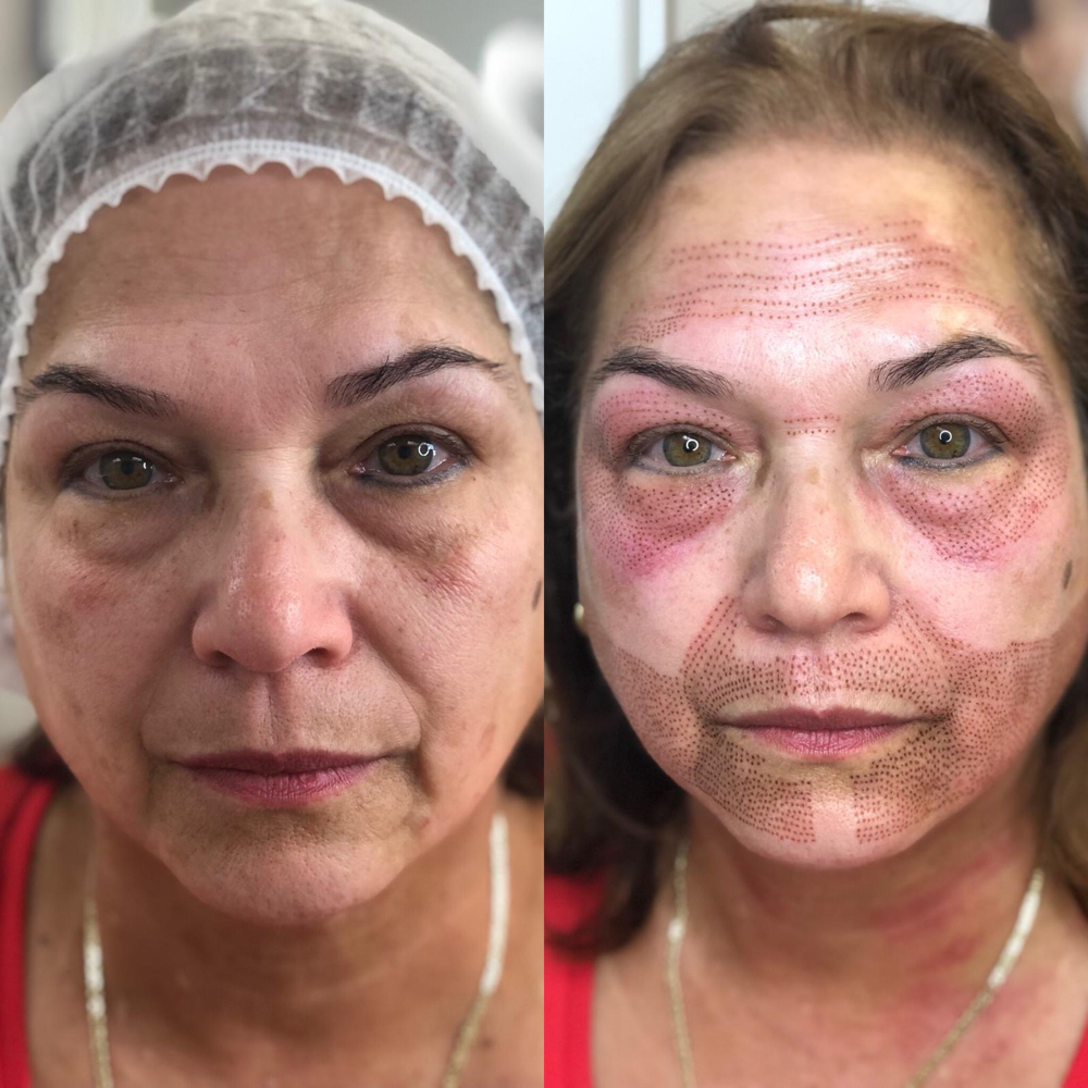 Expression Line at Leidy Cornelio Spa in Aurora, CO