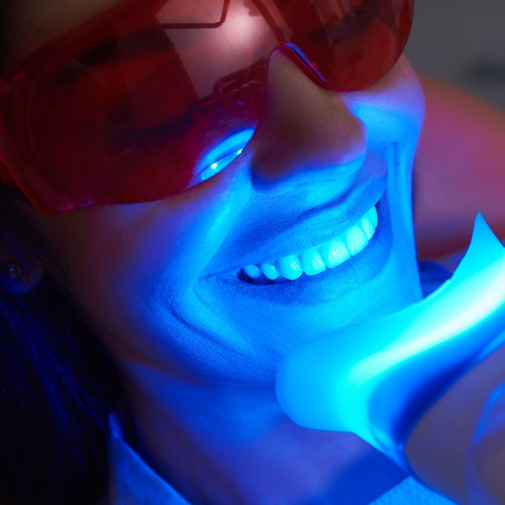 Teeth Whitening 60 min