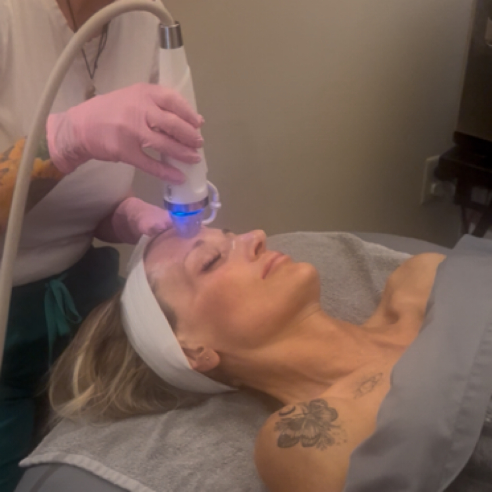 💐RF Microneedling Firming Facial at Kit’s Lash & Skin Studio at Soleil Spa in Pleasant Grove, UT