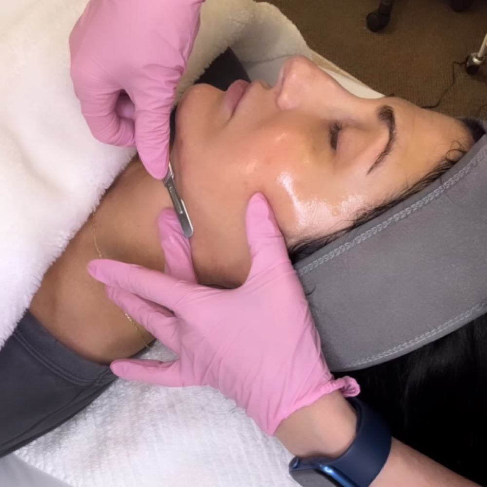 Dermaplane Facial W/ Mask and Cool Wand at Olivia Esthetics in Longview, TX