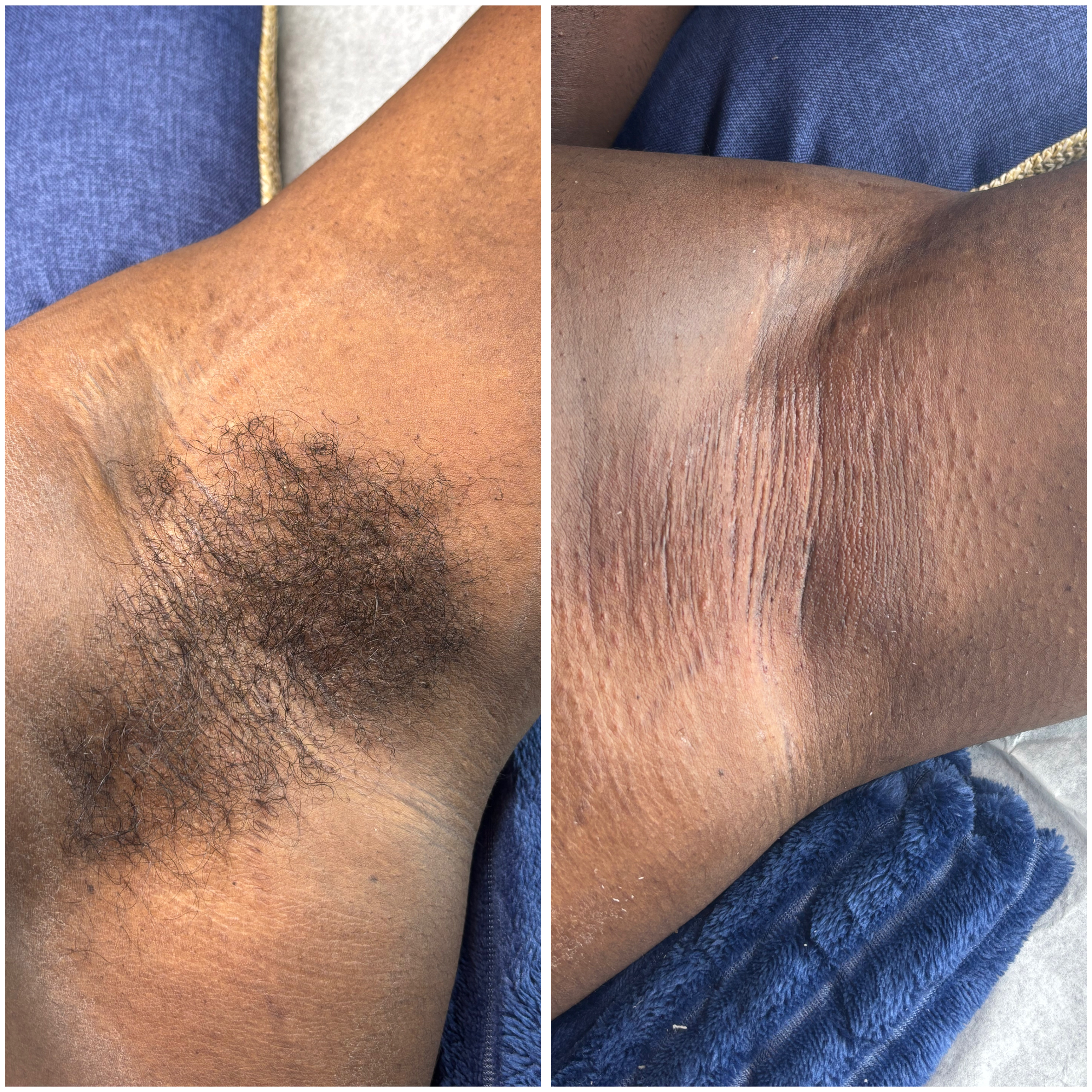 Armpit wax