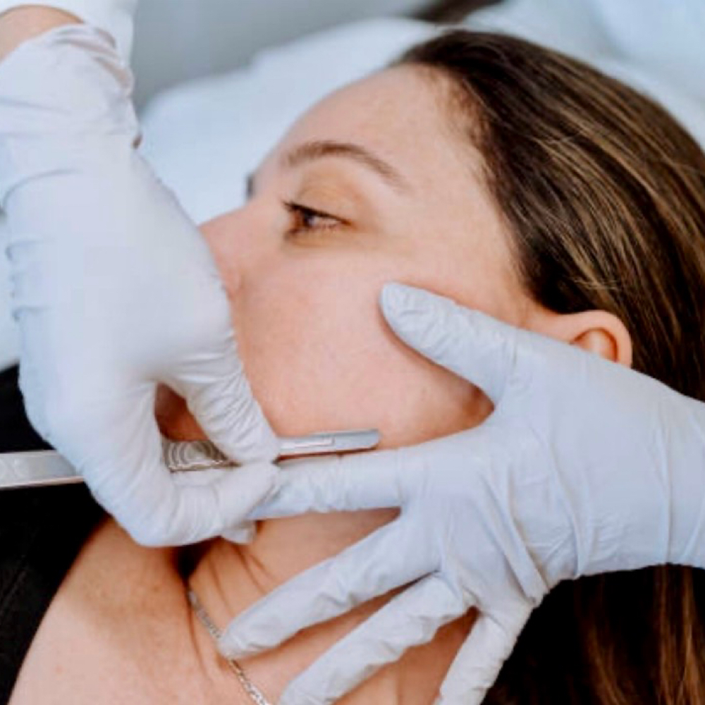 Dermaplane Add-On + at Ethereal Esthetics By Ashley in Flagstaff, AZ