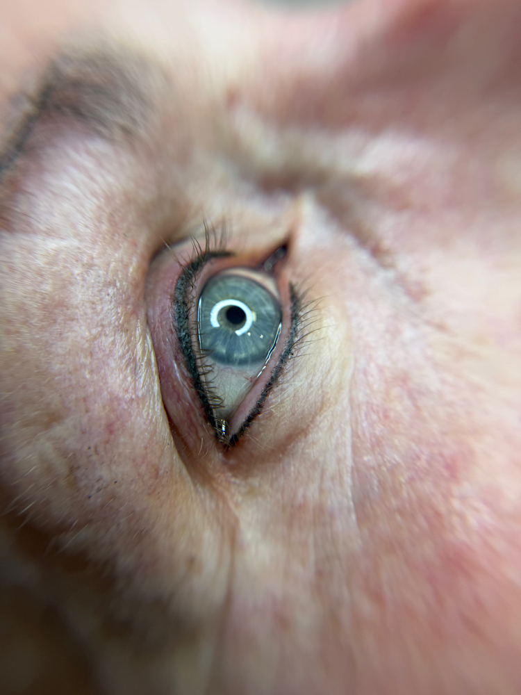 Top And Bottom Eyeliner