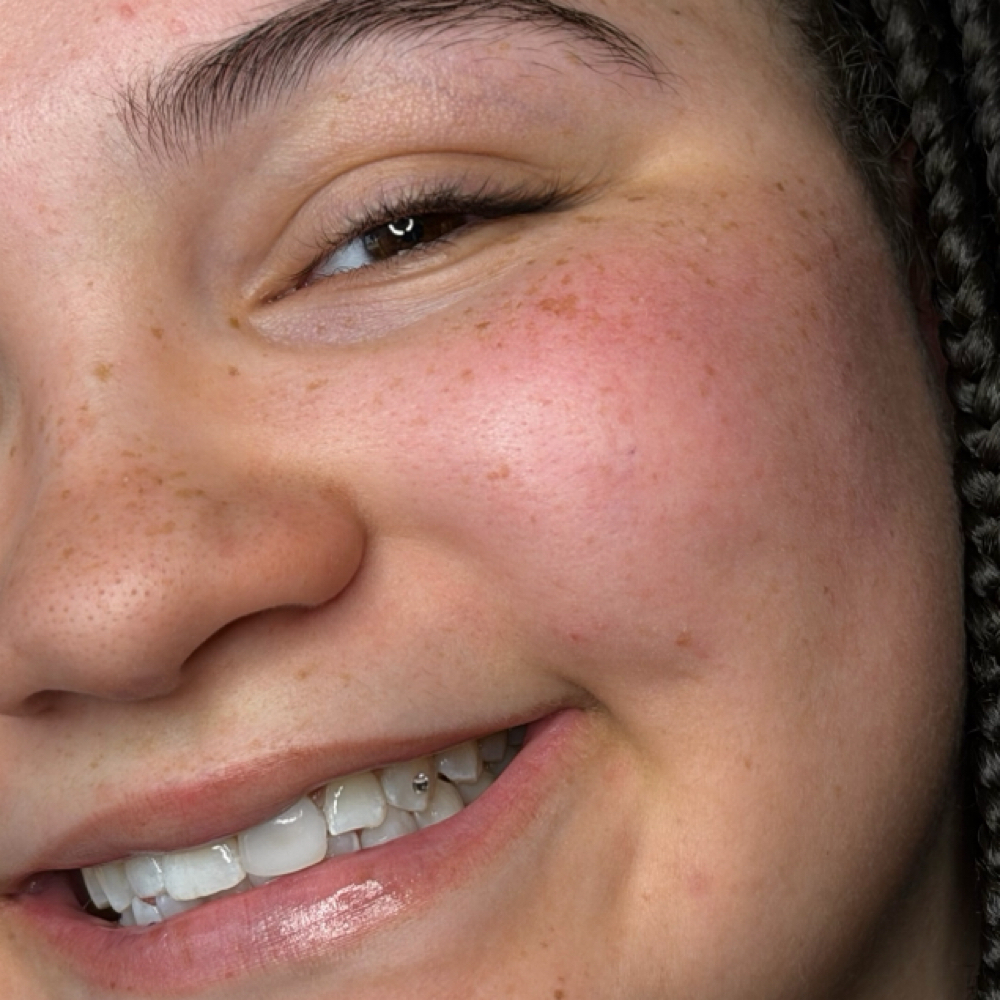 Single Tooth Gem at Sweetheart Haven in Tucson, AZ