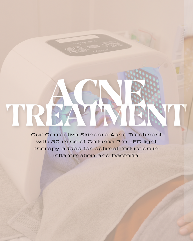 Corrective Skincare Acne Treatment  with Celluma  LED light therapy at Nourished SKN in Lathrup Village, MI