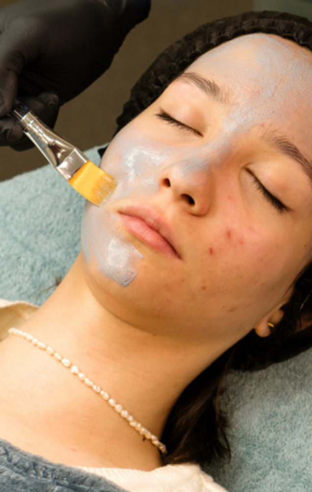 SKN Clear Acne Facial