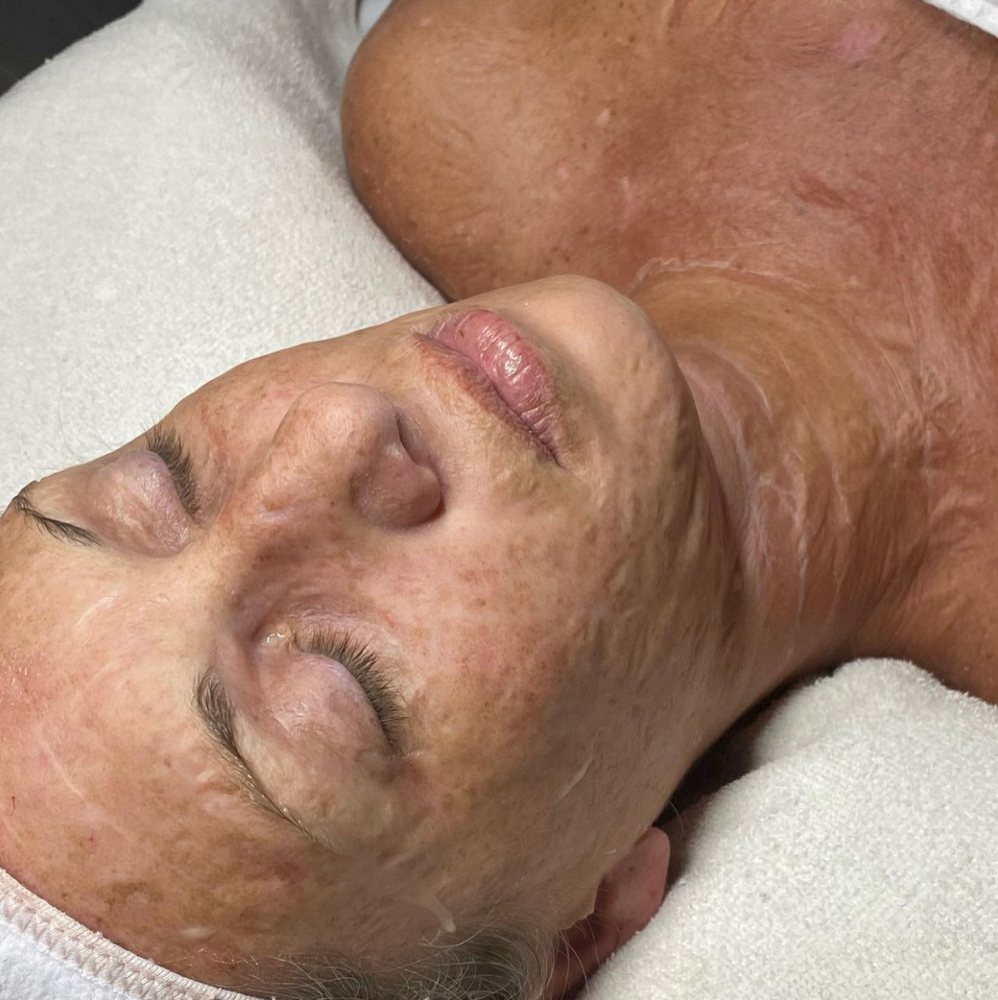 Argireline Contouring Facial