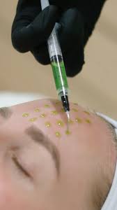 Biorepeel Peeling