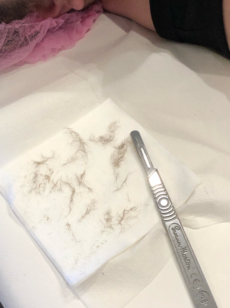 Dermaplane Facial