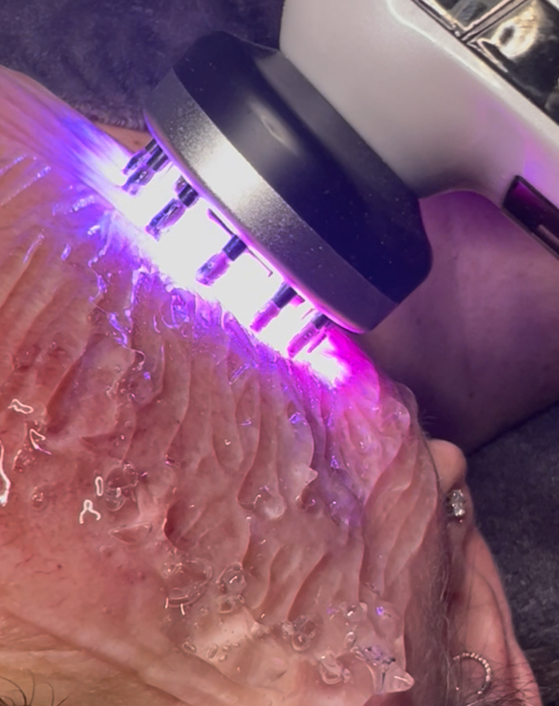 Anti- Aging Microcurrent Facial