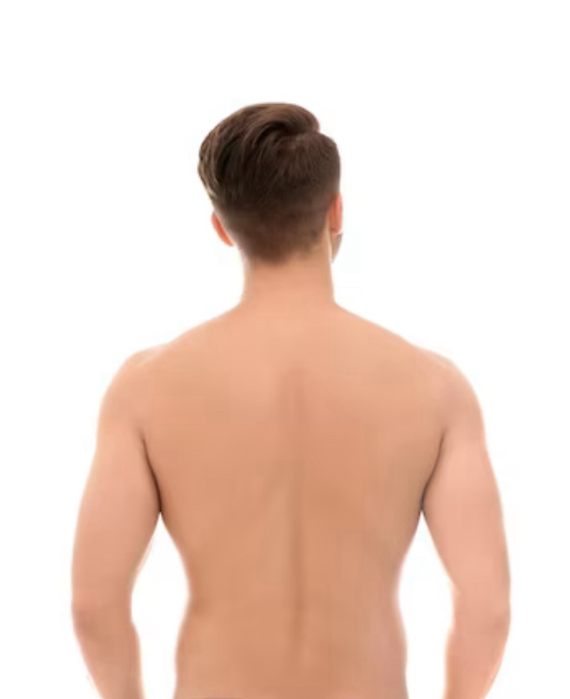 Fast/acting FullBack acne treatment