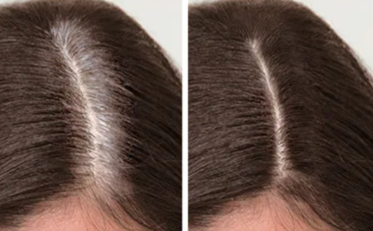 Root Retouch Or Shadow Root