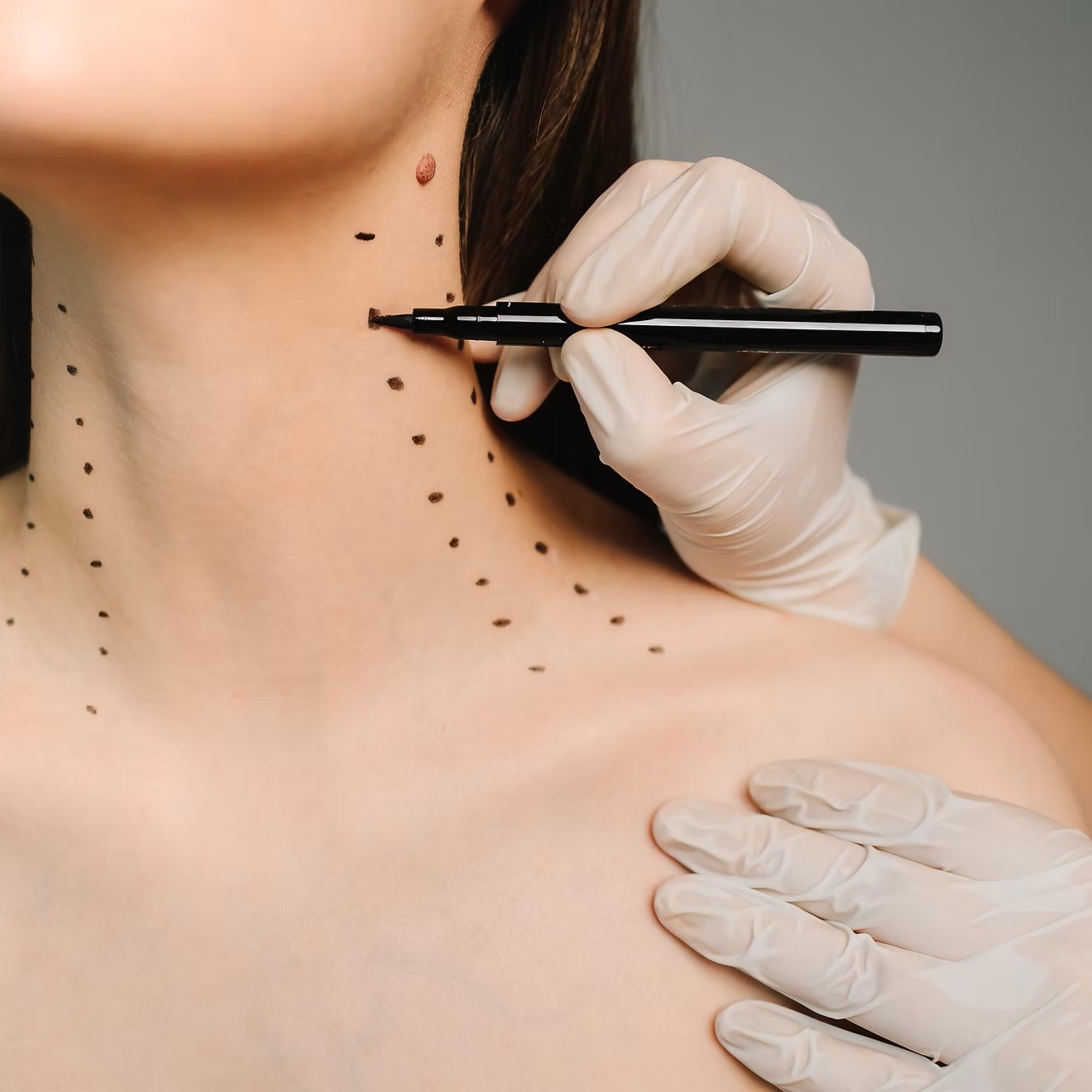 Jeuveau- Modified Nefertiti Jawline at RejuvX Aesthetics in Saugus, MA