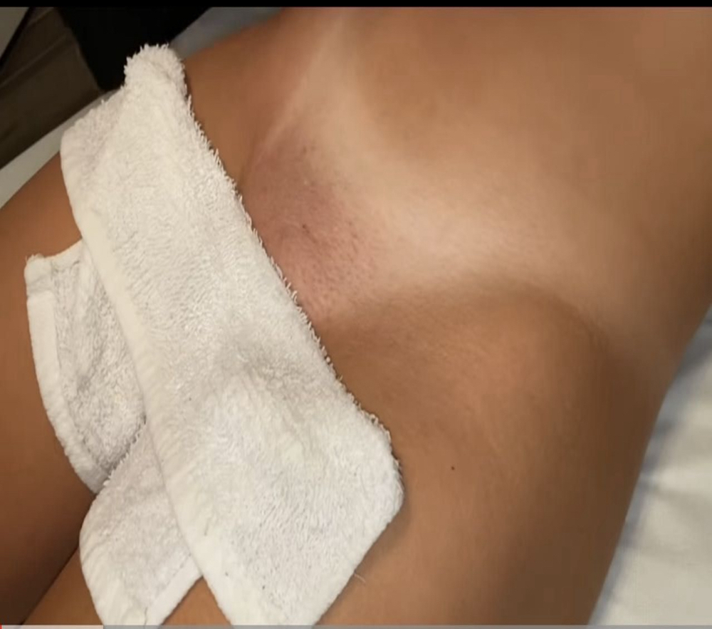 Brazilian Wax
