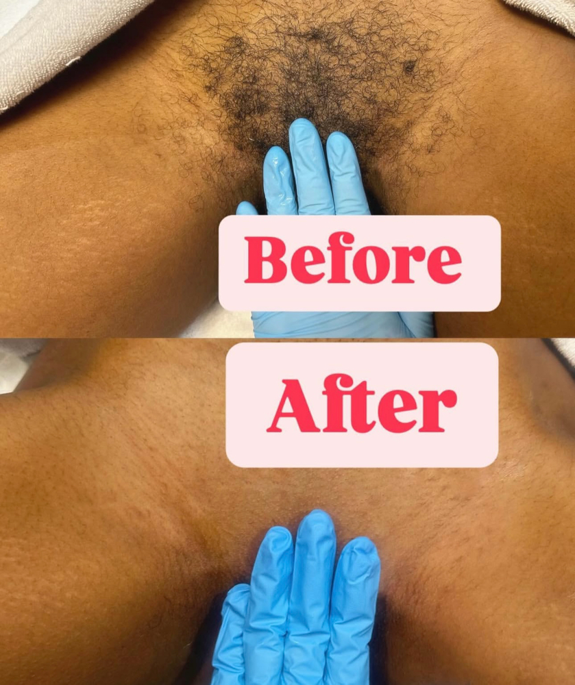Brazilian Wax