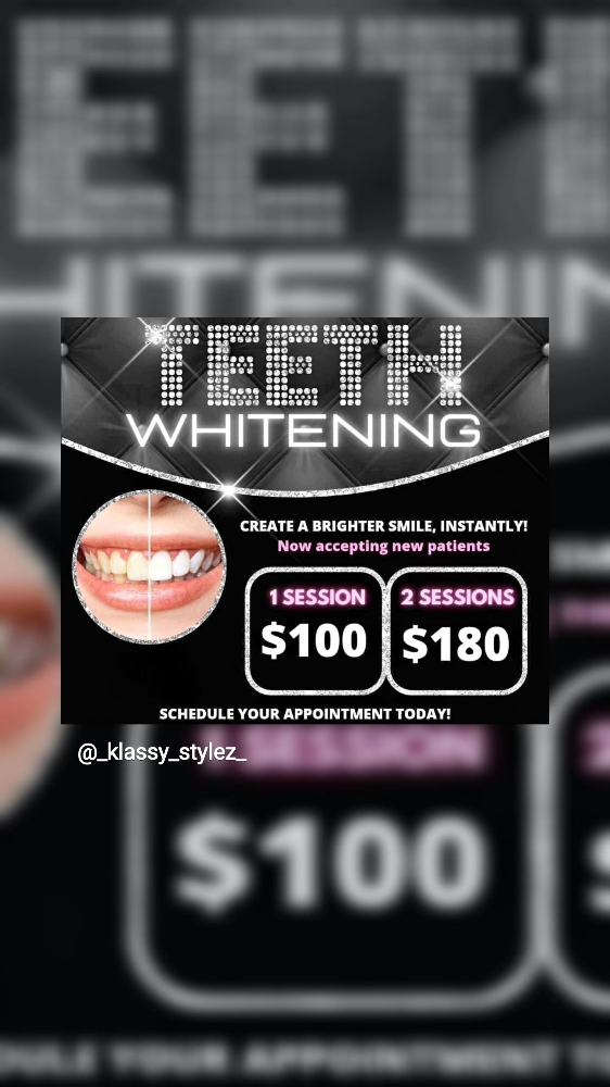 Teeth Whitening Special