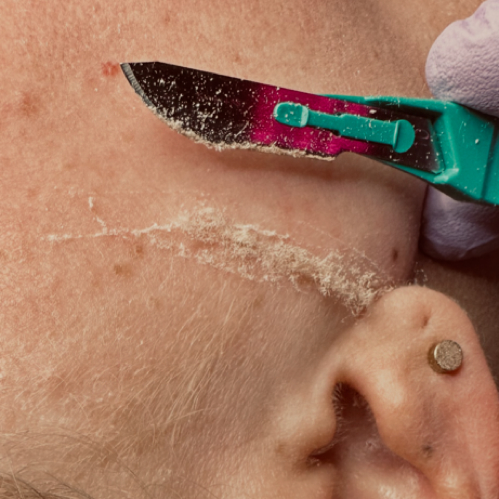 Dermaplane Facial at Erika’s Beauty Lab in Littleton, CO