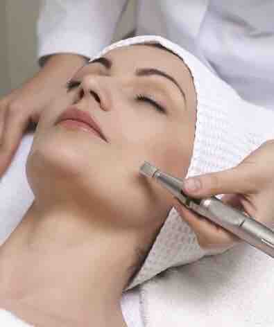 Microneedling