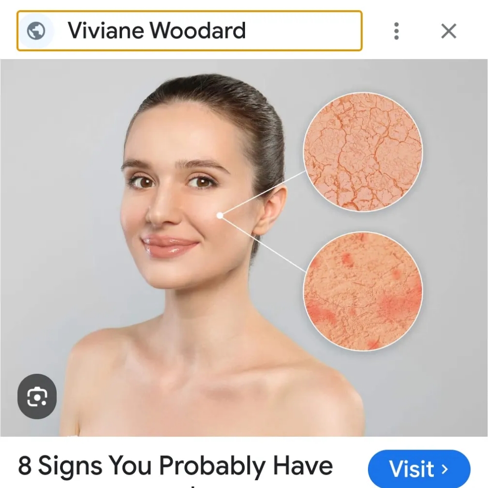 Rosacea And Sensitive Facial