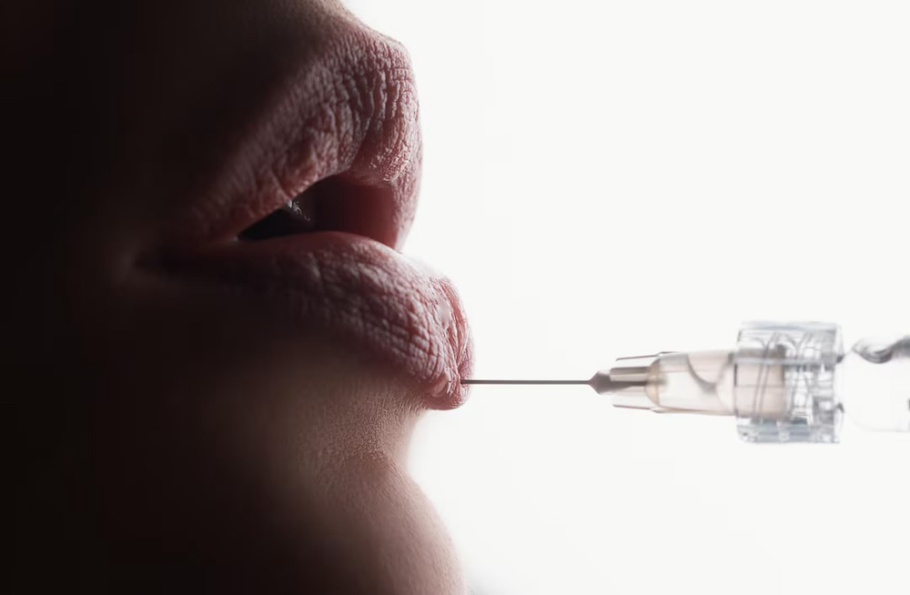 Signature Lips - Full Syringe
