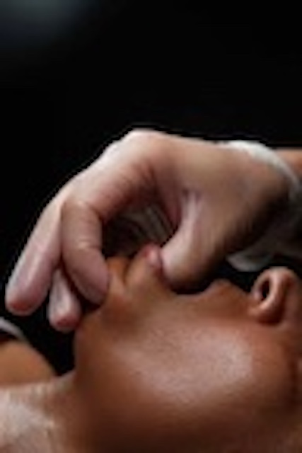 The Bloom Sculpt Facial