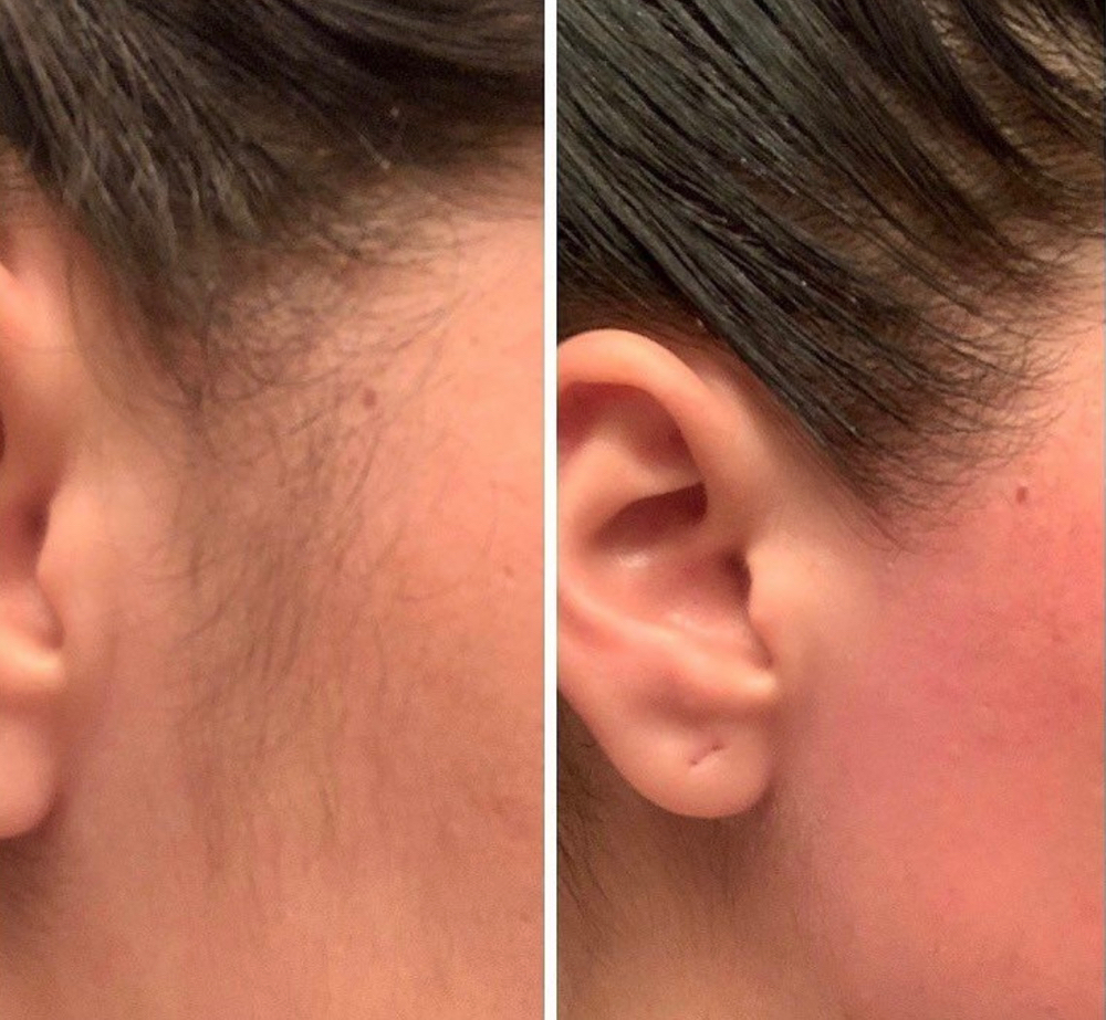 Sideburn/Cheek Wax