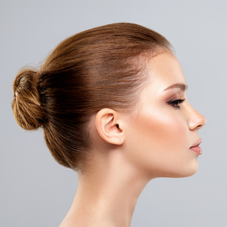 Cheek Filler