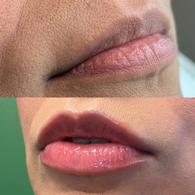 FRIDAY LIP FLIP at Glowtox Haus in San Antonio, TX