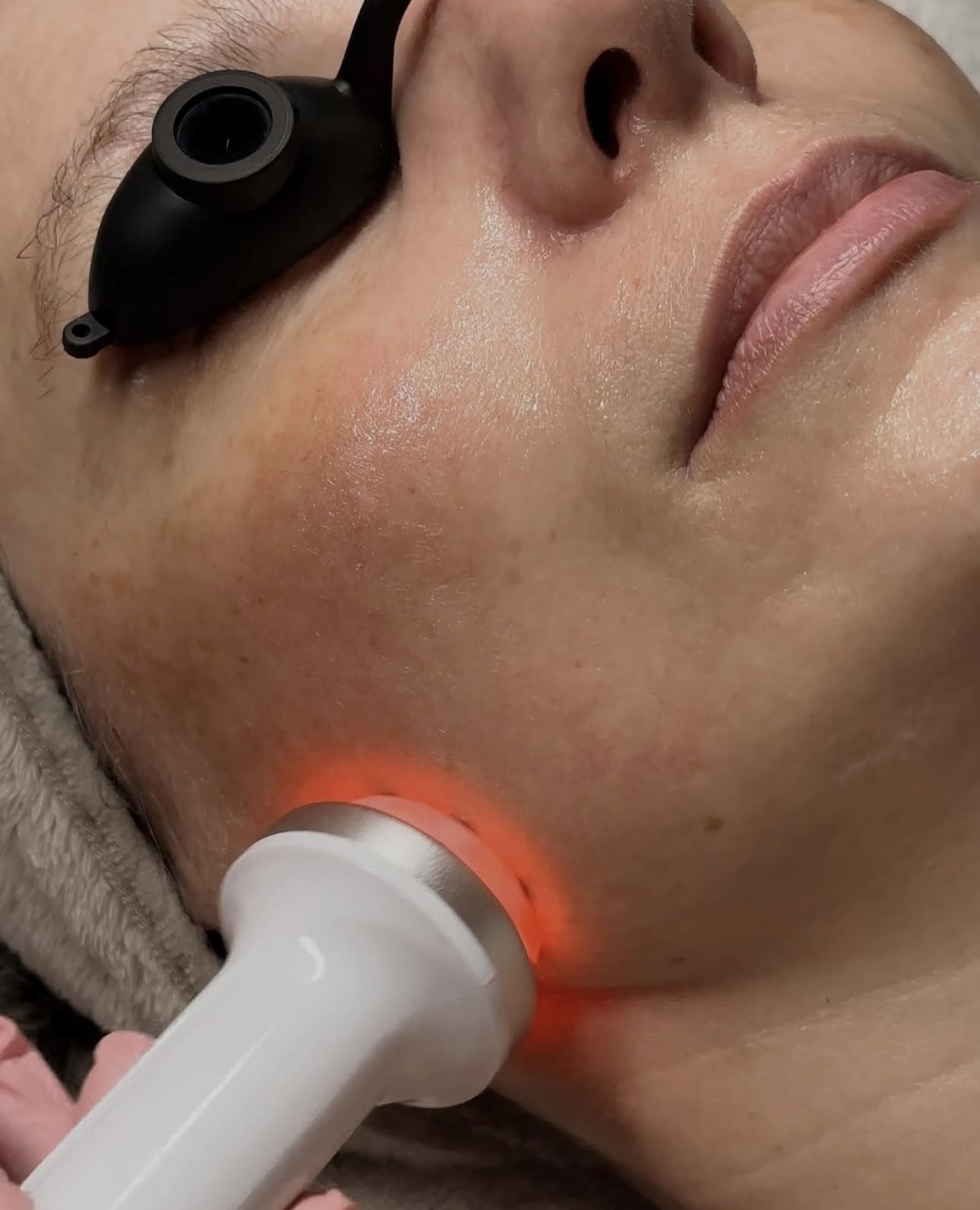 Radiofrequency &Microcurrent Facial