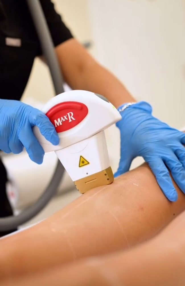 LASER HAIR REMOVAL