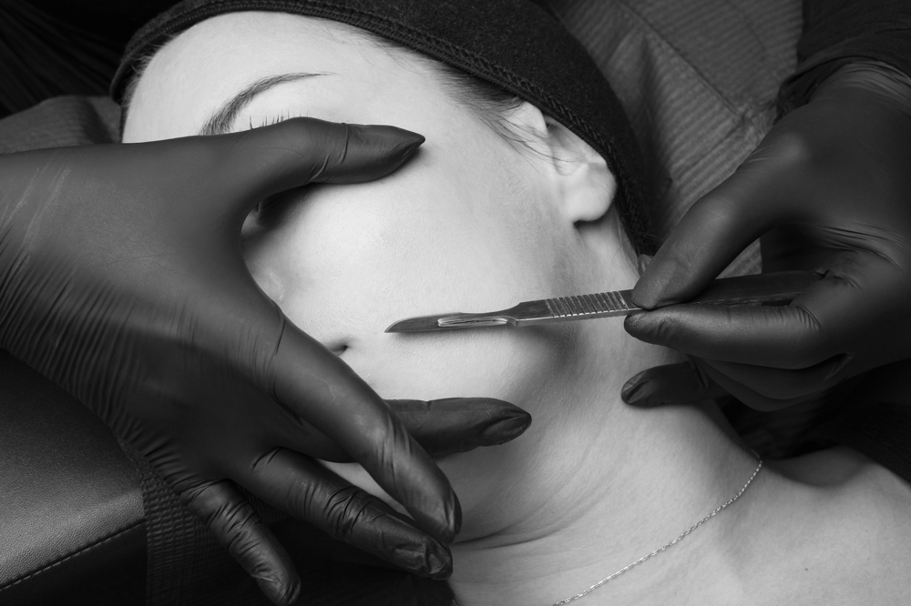 Dermaplaning Facial