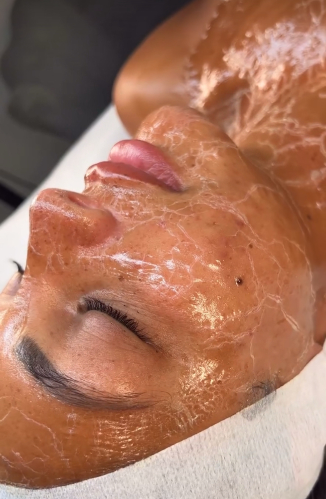 BOTOX Facial