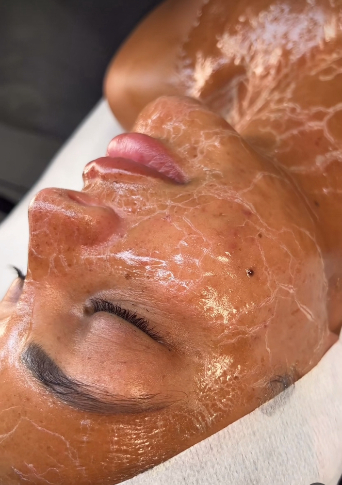 BOTOX Facial