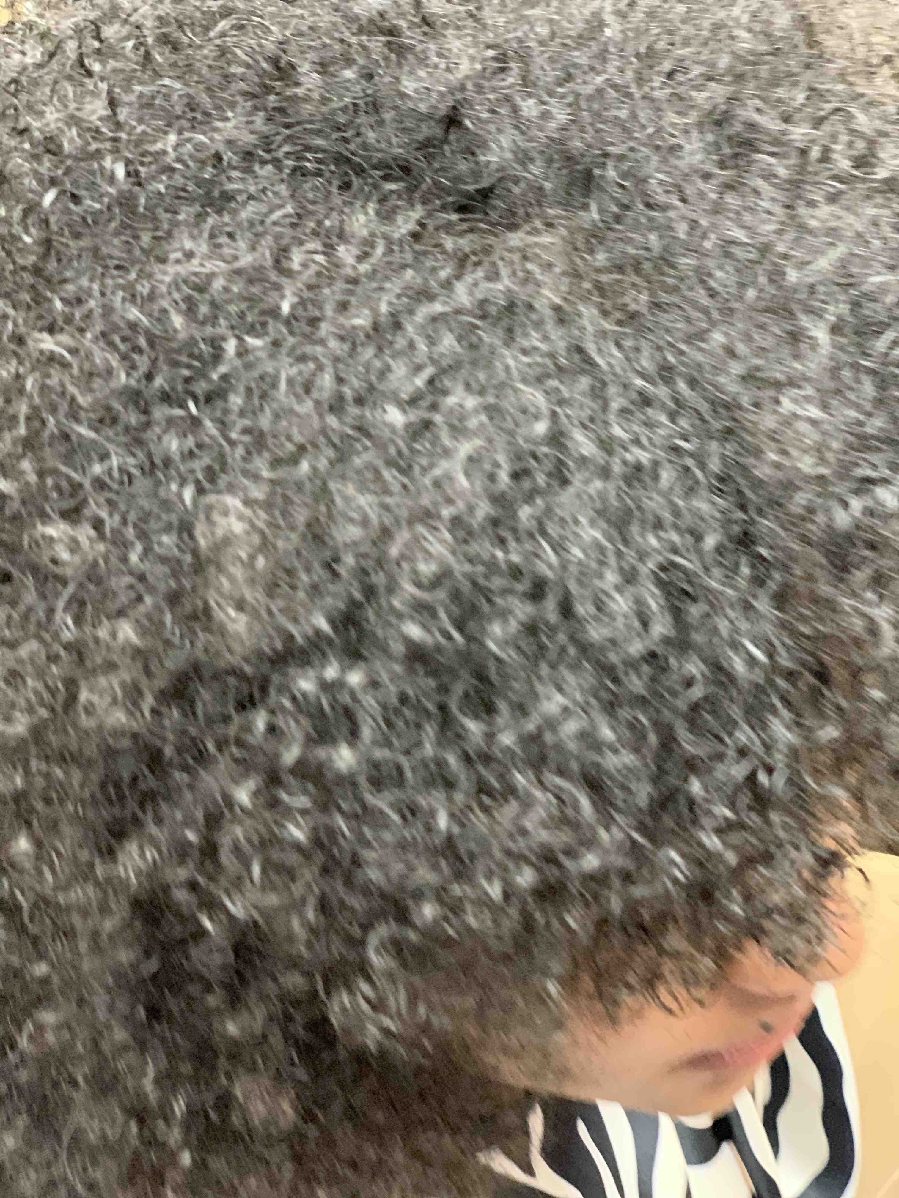 Loc Removal Full Head