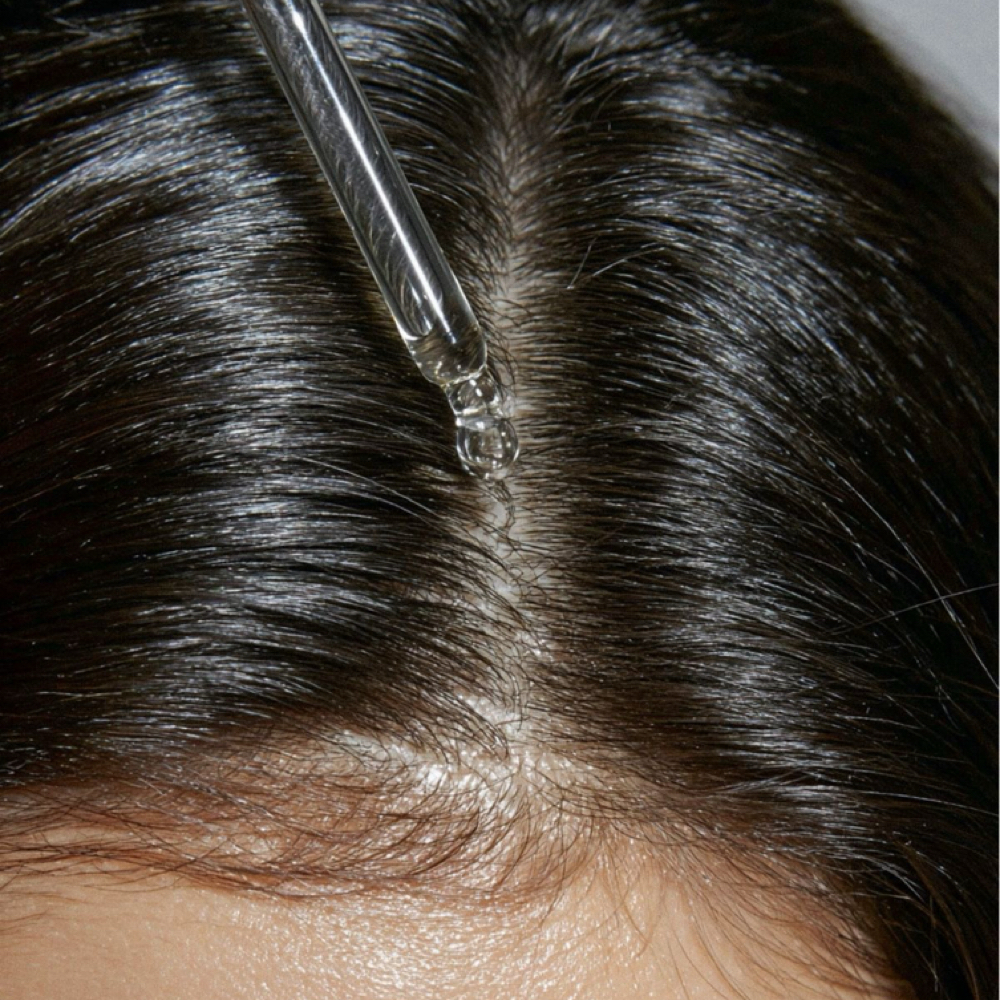 Microneedling- Hair Restoration at GLOW RIOT STUDIOS in Cary, NC