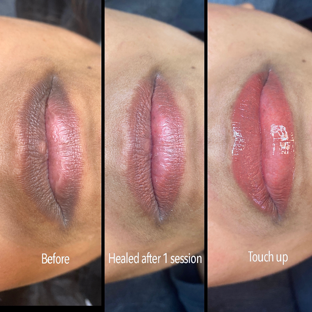 Lip Neutralization