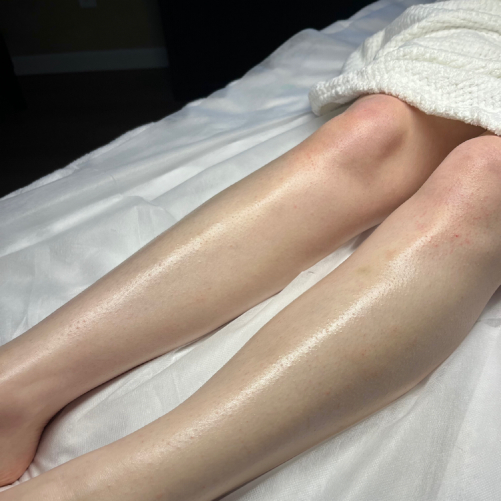 Full Leg Wax at Pearly Derm in Sun valley, CA