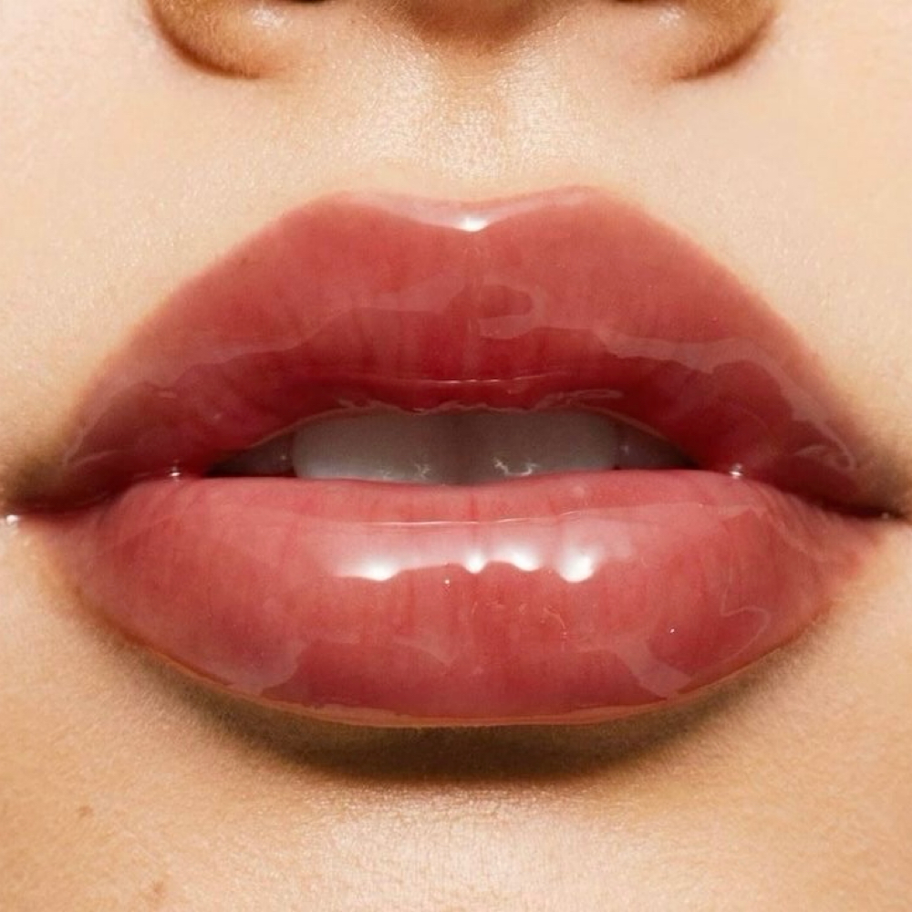 ADD ON: Lip Enhancement at Aura Esthetics in Wichita, KS