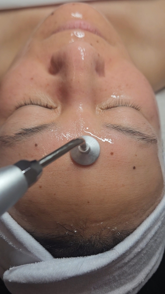 Carboxy Oxygen Facial w/ LED light