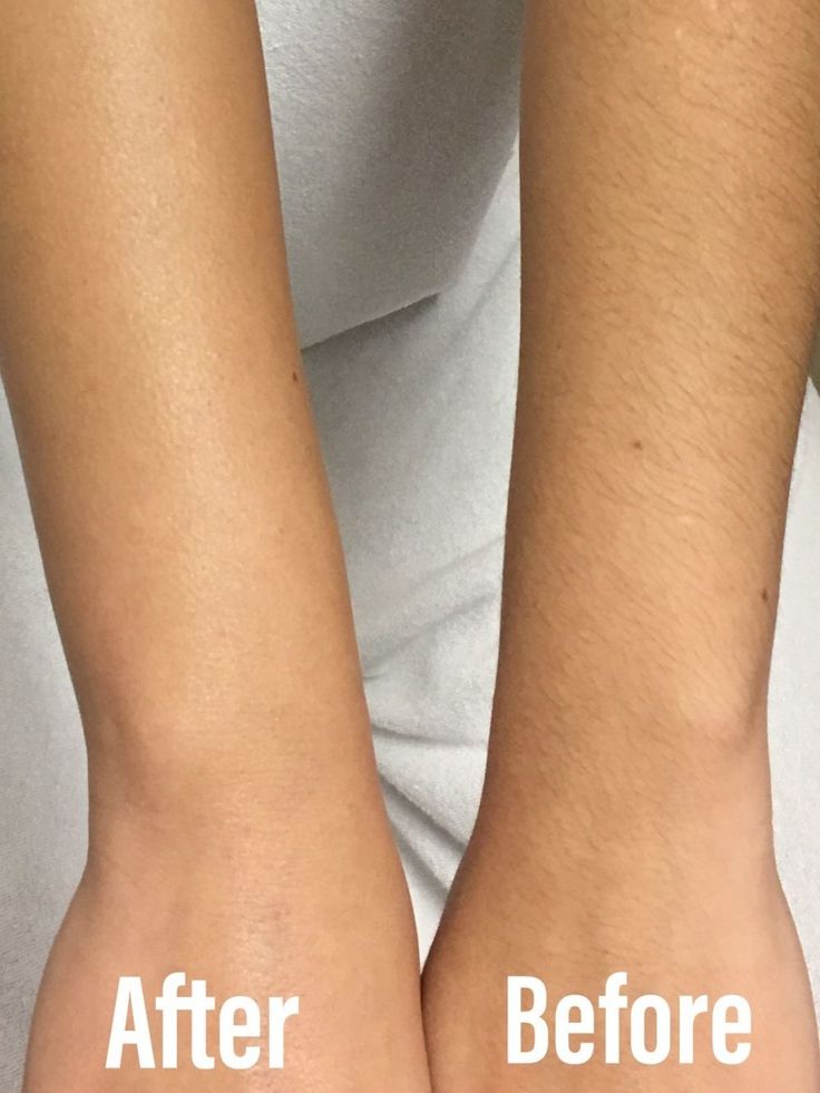 Half Arm Wax