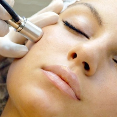 Microdermabrasion Treatment at LISA MCLAREN SKIN in Carrollton, TX